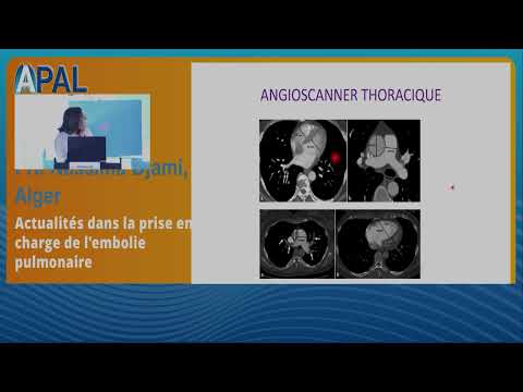 Actualités dans la prise en charge de l'embolie pulmonaire : Pre Nassima DJAMI (Alger)