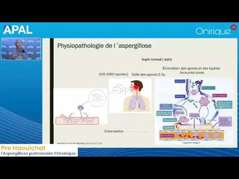 Webinar APAL
